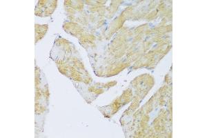 Immunohistochemistry of paraffin-embedded rat heart using DENR antibody (ABIN6133498, ABIN6139534, ABIN6139535 and ABIN6217790) at dilution of 1:150 (40x lens).