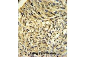 Immunohistochemistry (IHC) image for anti-FK506 Binding Protein 14, 22 KDa (FKBP14) antibody (ABIN3002691)