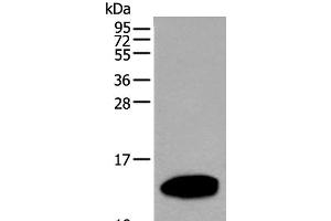 Western blot analysis of Human pancreas tissue lysate using REG1A Polyclonal Antibody at dilution of 1:500 (REG1A anticorps)