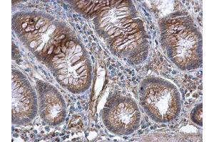 IHC-P Image GBP3 antibody [N1C1] detects GBP3 protein at cytoplasm in human colon by immunohistochemical analysis. (GBP3 anticorps)