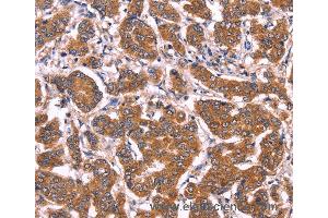 Immunohistochemistry of Human tonsil using COL20A1 Polyclonal Antibody at dilution of 1:40