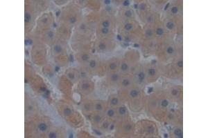 IHC-P analysis of Human Tissue, with DAB staining. (GCLC anticorps  (AA 429-637))