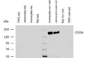 Western blotting analysis of human CD206 using mouse monoclonal antibody 15-2 on lysates of differentiated monocytes (two batches), and on THP-1 and Raji cells (negative controls) under reducing and non-reducing conditions.