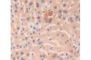 Used in DAB staining on fromalin fixed paraffin- embedded Kidney tissue (Grancalcin anticorps  (AA 39-220))
