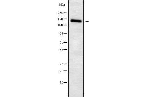 Western blot analysis SLC4A7 using HuvEc whole cell lysates (SLC4A7 anticorps  (Internal Region))