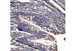IHC analysis of CPS1 using anti-CPS1 antibody (ABIN7599871). (CPS1 anticorps  (AA 124-379))