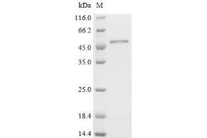 (Tris-Glycine gel) Discontinuous SDS-PAGE (reduced) with 5 % enrichment gel and 15 % separation gel.