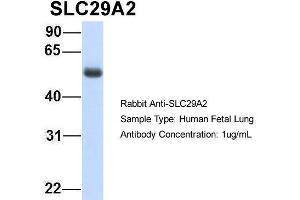 Host: Rabbit Target Name: SLC29A2 Sample Type: Human Fetal Lung Antibody Dilution: 1.