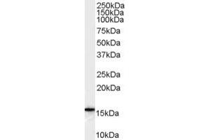 Western Blotting (WB) image for anti-DKFZp686P1551 (C-Term) antibody (ABIN2785710) (DKFZp686P1551 (C-Term) anticorps)