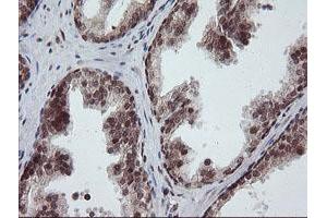 Image no. 5 for anti-Replication Factor C (Activator 1) 2, 40kDa (RFC2) (AA 1-234) antibody (ABIN1490617)