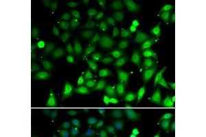 Immunofluorescence analysis of MCF-7 cells using RAE1 Polyclonal Antibody (RAE1 anticorps)