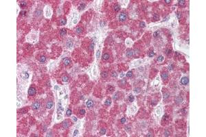 IHC testing of FFPE human liver tissue with ABCC5 antibody at 5ug/ml. (ABCC5 anticorps)