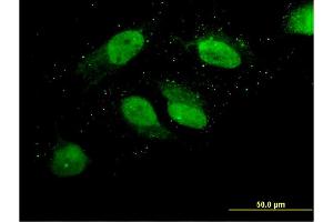 Immunofluorescence of monoclonal antibody to LOC220594 on HeLa cell. (LOC220594 (AA 255-354) anticorps)