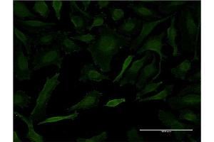 Immunofluorescence of monoclonal antibody to LETM1 on HeLa cell. (LETM1 anticorps  (AA 601-708))