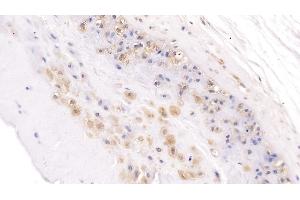 Detection of NOG in Human Placenta Tissue using Polyclonal Antibody to Noggin (NOG)