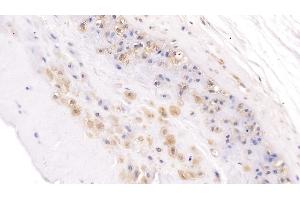 Detection of NOG in Human Placenta Tissue using Polyclonal Antibody to Noggin (NOG) (NOG anticorps  (AA 28-232))