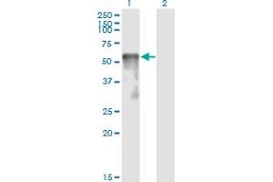 Western Blot analysis of SESN2 expression in transfected 293T cell line by SESN2 monoclonal antibody (M03), clone 3B8.