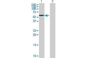 Western Blot analysis of ENTPD3 expression in transfected 293T cell line by ENTPD3 MaxPab polyclonal antibody. (ENTPD3 anticorps  (AA 1-452))