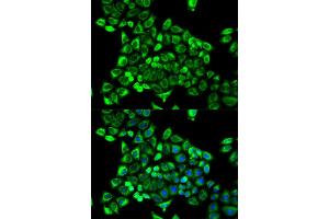 Immunofluorescence analysis of MCF-7 cells using CDA antibody.