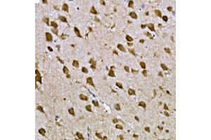 Immunohistochemistry of paraffin-embedded mouse brain using CPEB3 Rabbit pAb (ABIN7266666) at dilution of 1:300 (40x lens).