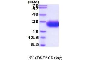 SDS-PAGE (SDS) image for Sodium Channel, Voltage-Gated, Type III, beta Subunit (SCN3B) (AA 23-159) protein (His tag) (ABIN5854809)