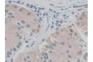 Detection of SGSH in Human Stomach Tissue using Polyclonal Antibody to N-Sulfoglucosamine Sulfohydrolase (SGSH)