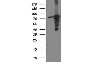 Western Blotting (WB) image for anti-Protein Kinase C, epsilon (PRKCE) antibody (ABIN1500235) (PKC epsilon anticorps)