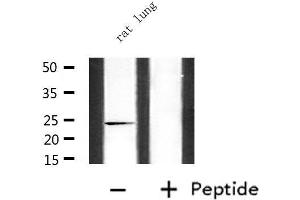 Western blot analysis of extracts from rat lung, using CDKN3 Antibody. (CDKN3 anticorps  (Internal Region))