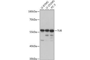 Western blot analysis of extracts of various cell lines, using TUB antibody (ABIN7271024) at 1:1000 dilution.