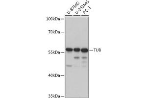 Western blot analysis of extracts of various cell lines, using TUB antibody (ABIN7271024) at 1:1000 dilution. (TUB anticorps  (AA 130-230))