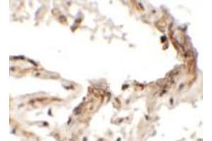 Immunohistochemical analysis of EMX2 in human lung tissue with EMX2 polyclonal antibody  at 2. (EMX2 anticorps  (Internal Region))