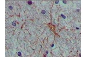 Immunohistochemistry (IHC) image for anti-S100 Calcium Binding Protein A1 (S100A1) (truncated) antibody (ABIN2464101)