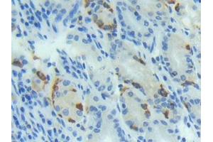 DAB staining on IHC-P; Samples: Human Stomach Tissue (BMP4 anticorps  (AA 293-408))