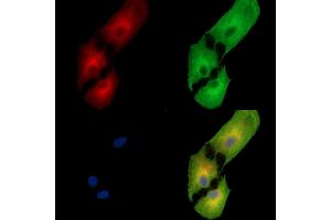 ABIN7095399 and ABIN7099456 staining  cells by IF/ICC.