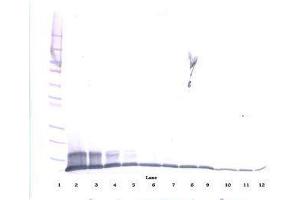 Image no. 1 for anti-Chemokine (C-C Motif) Ligand 20 (CCL20) antibody (ABIN465457) (CCL20 anticorps)