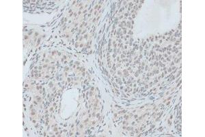 Immunohistochemistry of paraffin-embedded Rat ovary using ZNF416 Polyclonal Antibody at dilution of 1:100 (40x lens). (ZNF416 anticorps)