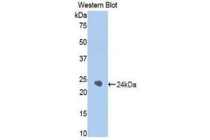 Western Blotting (WB) image for anti-serpin Peptidase Inhibitor, Clade A (Alpha-1 Antiproteinase, Antitrypsin), Member 6 (SERPINA6) (AA 173-344) antibody (ABIN1858269)