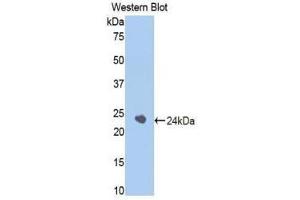 Western Blotting (WB) image for anti-serpin Peptidase Inhibitor, Clade A (Alpha-1 Antiproteinase, Antitrypsin), Member 6 (SERPINA6) (AA 173-344) antibody (ABIN1858269) (SERPINA6 anticorps  (AA 173-344))