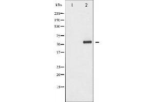 Western blot analysis of HDAC1 phosphorylation expression in EGF treated Jurkat whole cell lysates,The lane on the left is treated with the antigen-specific peptide. (HDAC1 anticorps  (pSer421))