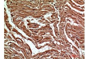 Immunohistochemistry (IHC) analysis of paraffin-embedded Human Heart, antibody was diluted at 1:200. (C-Type Lectin Domain Family 6, Member A (CLEC6A) anticorps)