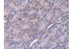 DAB staining on IHC-P; Samples: Rat Kidney Tissue (ERP29 anticorps  (AA 42-173))