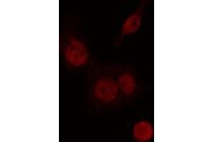 ABIN6274235 staining Hela cells by IF/ICC. (CIITA anticorps  (Internal Region))
