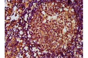 IHC image of ABIN7143386 diluted at 1:500 and staining in paraffin-embedded human lymph node tissue performed on a Leica BondTM system. (ADGRE2 anticorps  (AA 151-323))