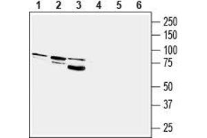 Western blot analysis of rat brain (lanes 1 and 4), mouse brain (lanes 2 and 5) and human U-87 MG glioblastoma cell line (lanes 3 and 6) lysates: - 1-3. (PTGFR anticorps  (3rd Intracellular Loop))