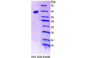 SDS-PAGE (SDS) image for CD99 (CD99) (AA 27-161) protein (His tag) (ABIN6238911) (CD99 Protein (CD99) (AA 27-161) (His tag))
