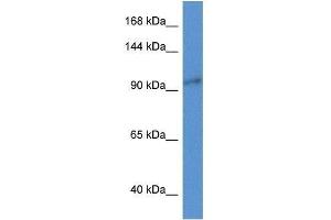 anti-Zinc Finger CCCH-Type Containing 3 (ZC3H3) (N-Term) antibody