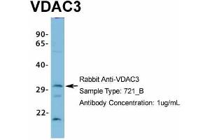 Host: Rabbit Target Name: VDAC3 Sample Type: 721_B Antibody Dilution: 1.