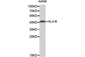Western blot analysis of extracts of Jurkat cell line, using HLA-B antibody. (HLA-B anticorps  (AA 1-100))