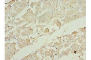 Immunohistochemistry of paraffin-embedded human heart tissue using ABIN7167216 at dilution of 1:100