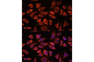 Immunofluorescence analysis of L929 cells using PI4KB antibody (ABIN7269287) at dilution of 1:100.